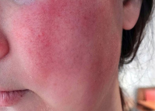 FTT-Roi-loan-lo-au-xa-hoi-la-gi-phan-biet-voi-tinh-nhut-nhat-1