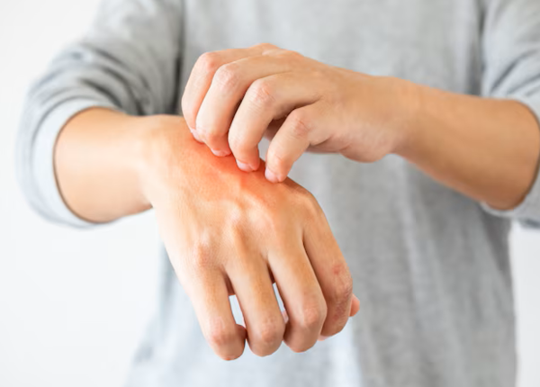 Cảm giác ngứa, tê như kiến bò dễ gặp người ảo giác xúc giác
