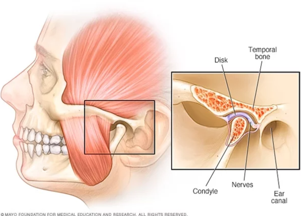 Cơn đau đầu có thể do bị rối loạn khớp thái dương hàm